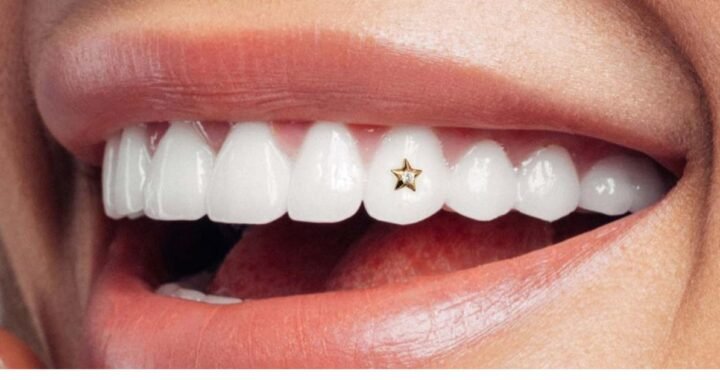 Diamond in Tooth: The Ultimate Guide to Tooth Gems & Costs