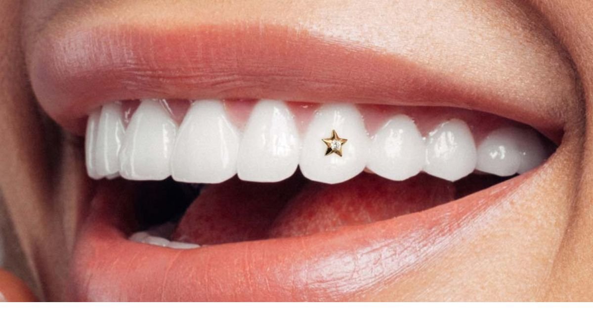 Diamond in Tooth