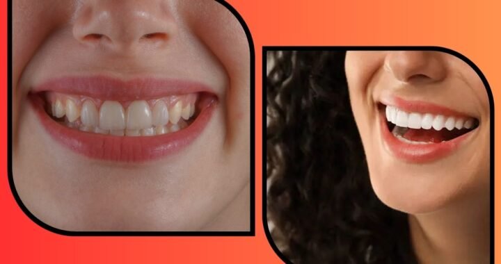 Cosmetic Dentistry Is Becoming an Essential Part of Modern Beauty Routines