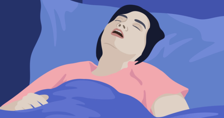 Mouthpiece for Snoring: Better Sleep Starts Here