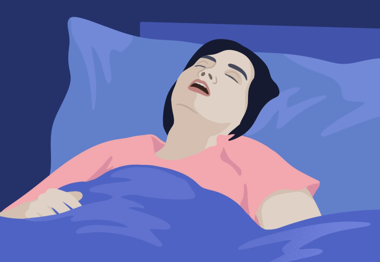 Snoring